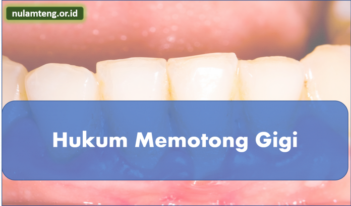 hukum-memotong-gigi